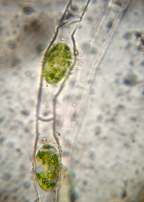 Azzardo: Spirogyra varians....?